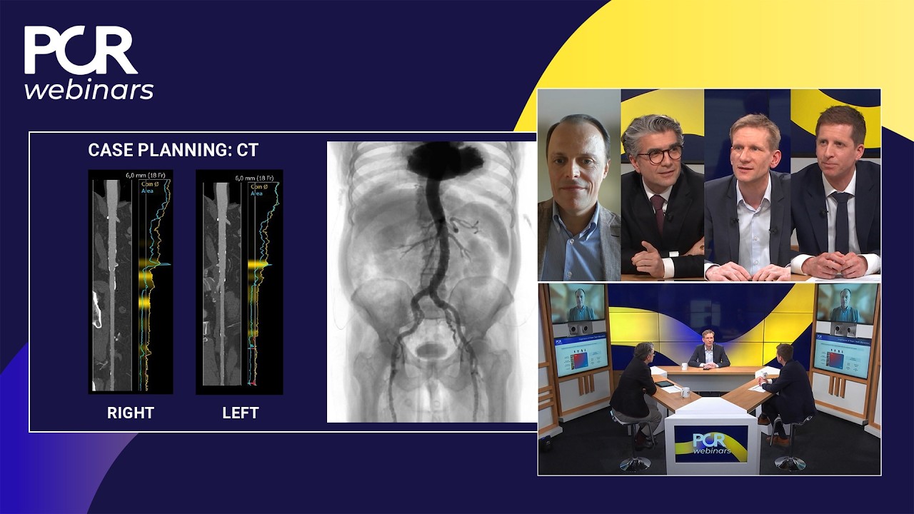 Revisiting aortic valve replacement in light of the new ESC/EACTS guidelines - Webinar