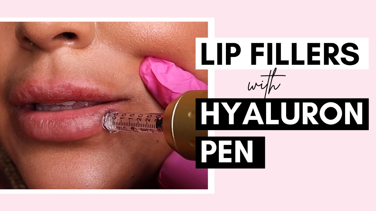 No Needle Lip Filler With Hyaluron Pen | Procedure And Aftercare Ft @SaigeWellington