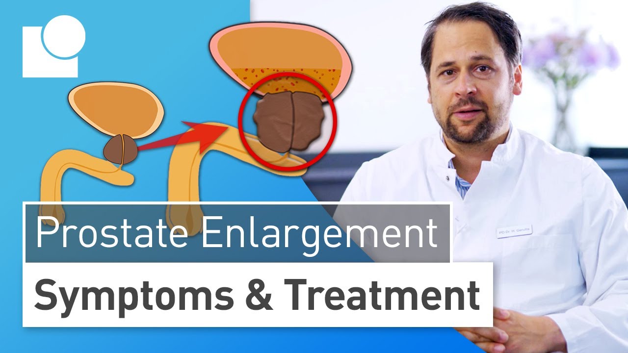 Prostate Enlargement: This Helps with the Urge to Urinate & Weak Urine Flow | Symptoms & Treatment