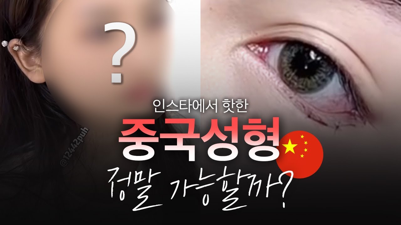 [SNS에서 핫한 중국 성형] 실제로 가능할까?🤔