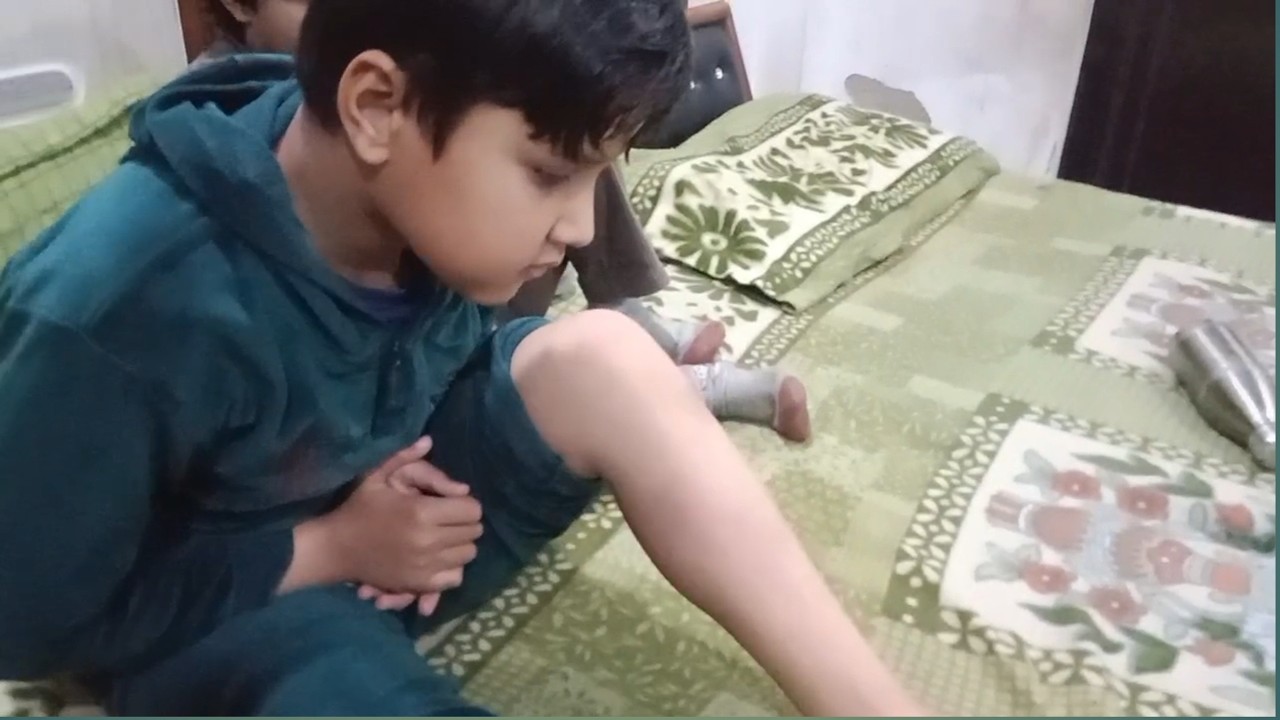 हनु के लग गई चोट