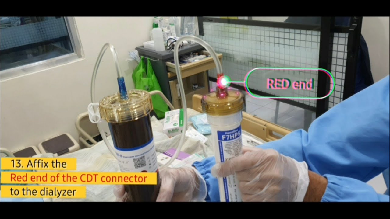 Hemoperfusion plus Hemodialysis: Preparation/ Setting up Guide