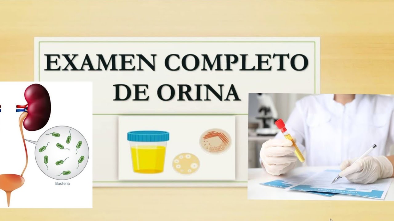 Guía Completa del Examen de Orina: Todo lo que Necesitas Saber para empezar