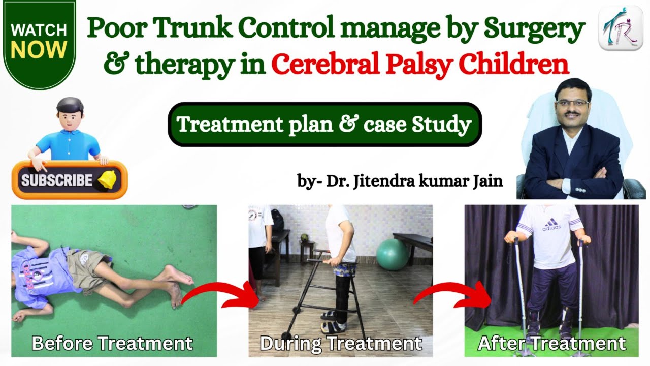 Poor Trunk Control with Limb Deformity in Cerebral Palsy | Exercises, Treatment | Trishla Foundation