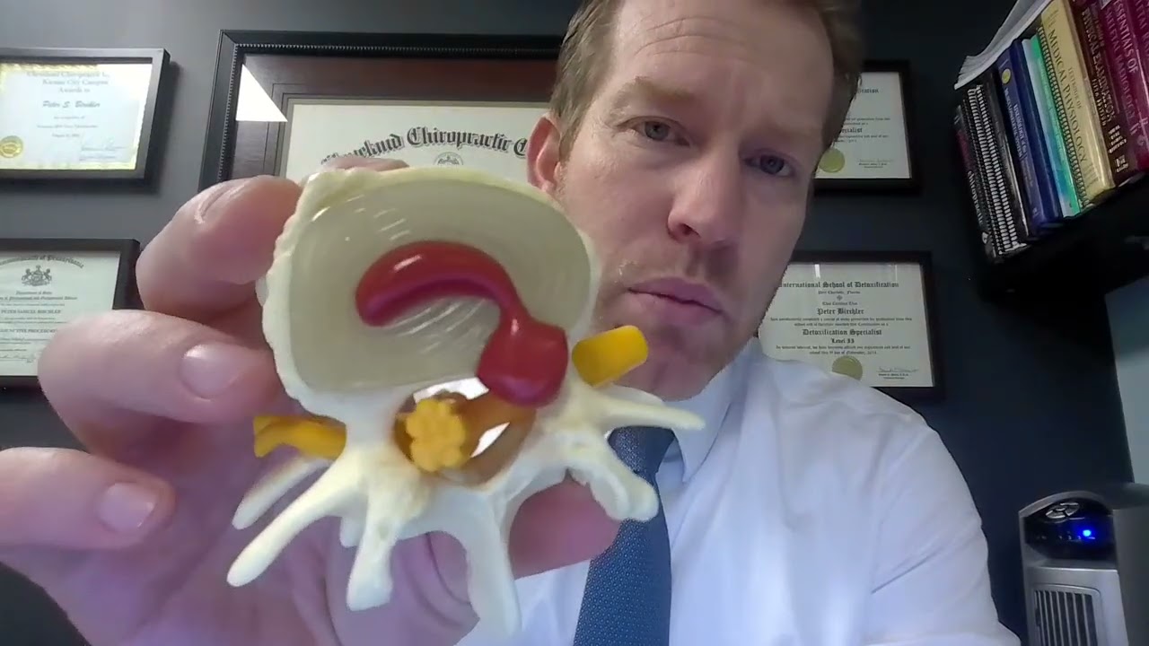 Understanding Ice vs  Heat for Back Pain Relief ❄️