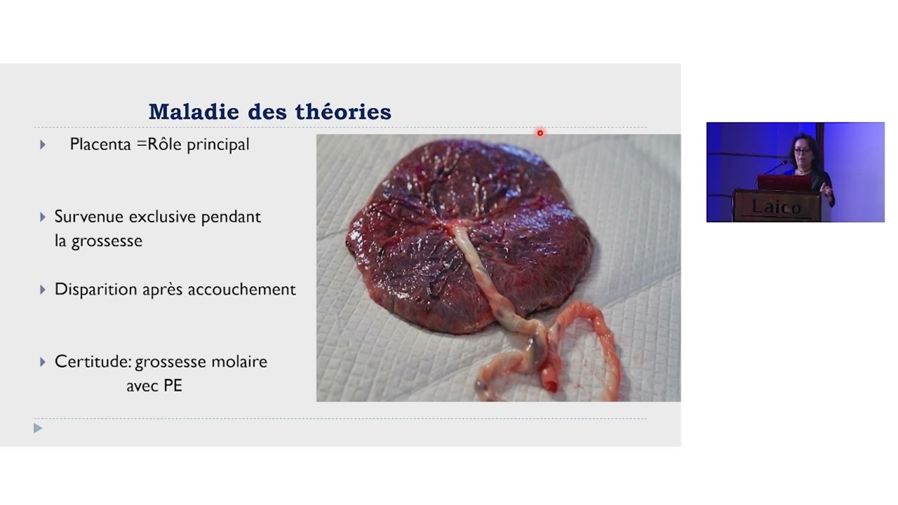 Physiopathologie de la prééclampsie 04 12 21 Laico Salle 1 part 1
