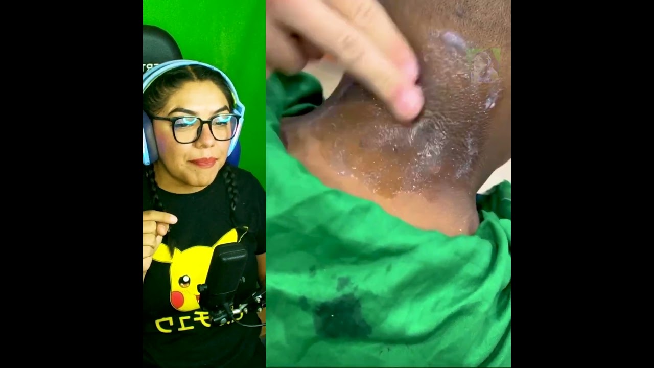 &iexcl;Aclarado instant&aacute;neo! &iquest;Realmente funciona esta crema para blanquear la piel al instante? 😱