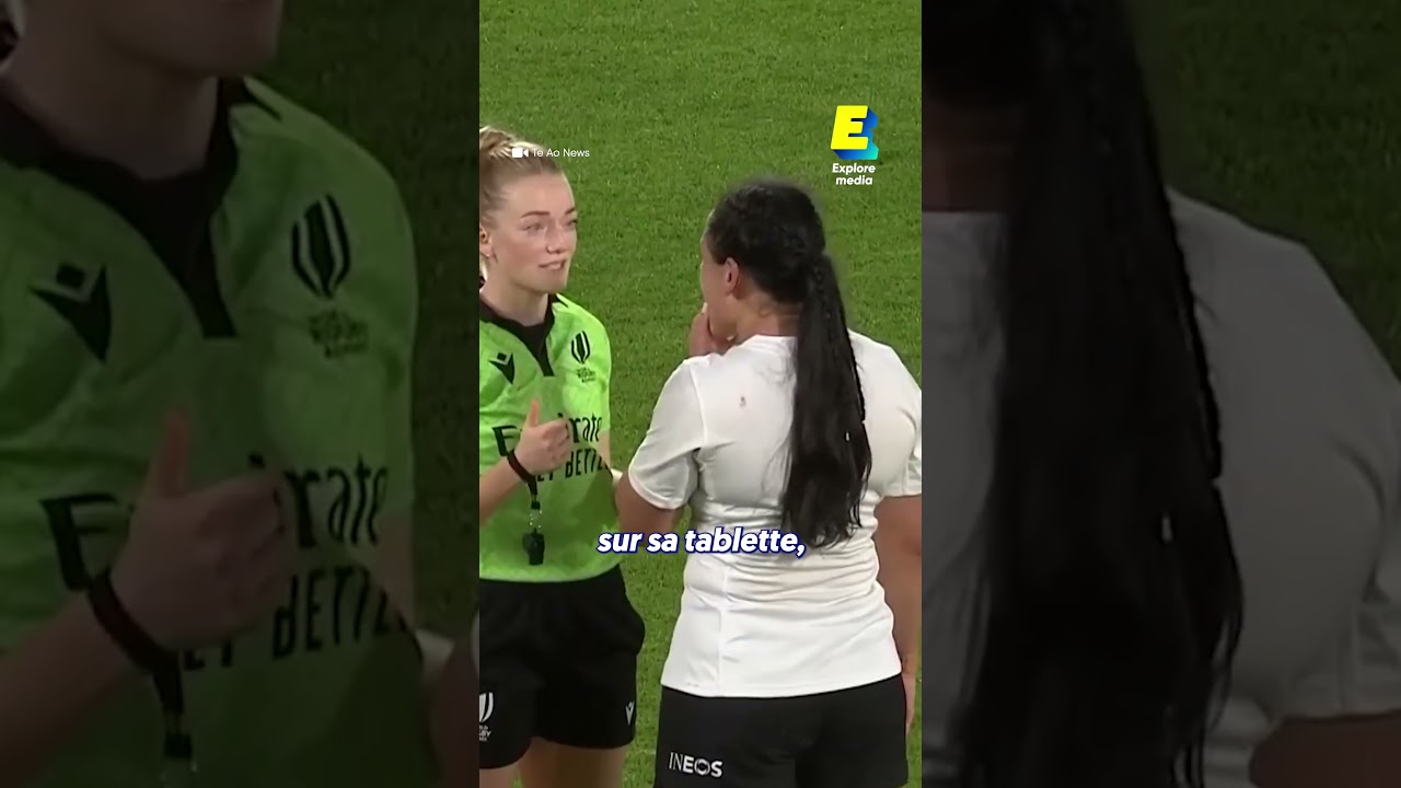 Ce prot&egrave;ge-dents r&eacute;volutionne le rugby 🏉 #shorts