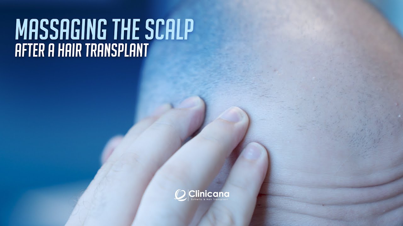 Massaging The Scalp After A Hair Transplant