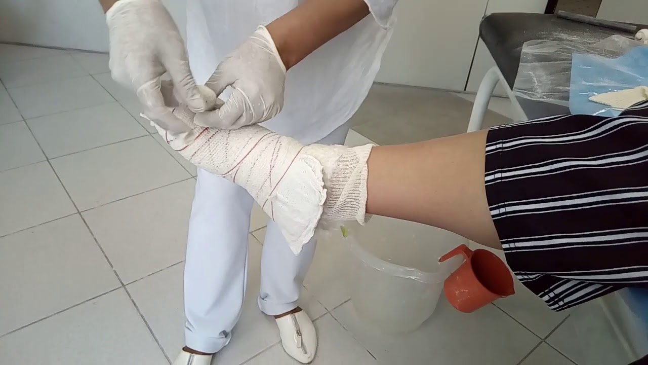 Sandália  gessada para o halux