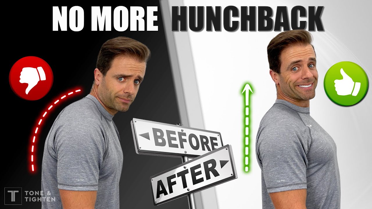 Fix Your Posture! 10-Minute Routine To Eliminate &ldquo;Hunchback&rdquo;