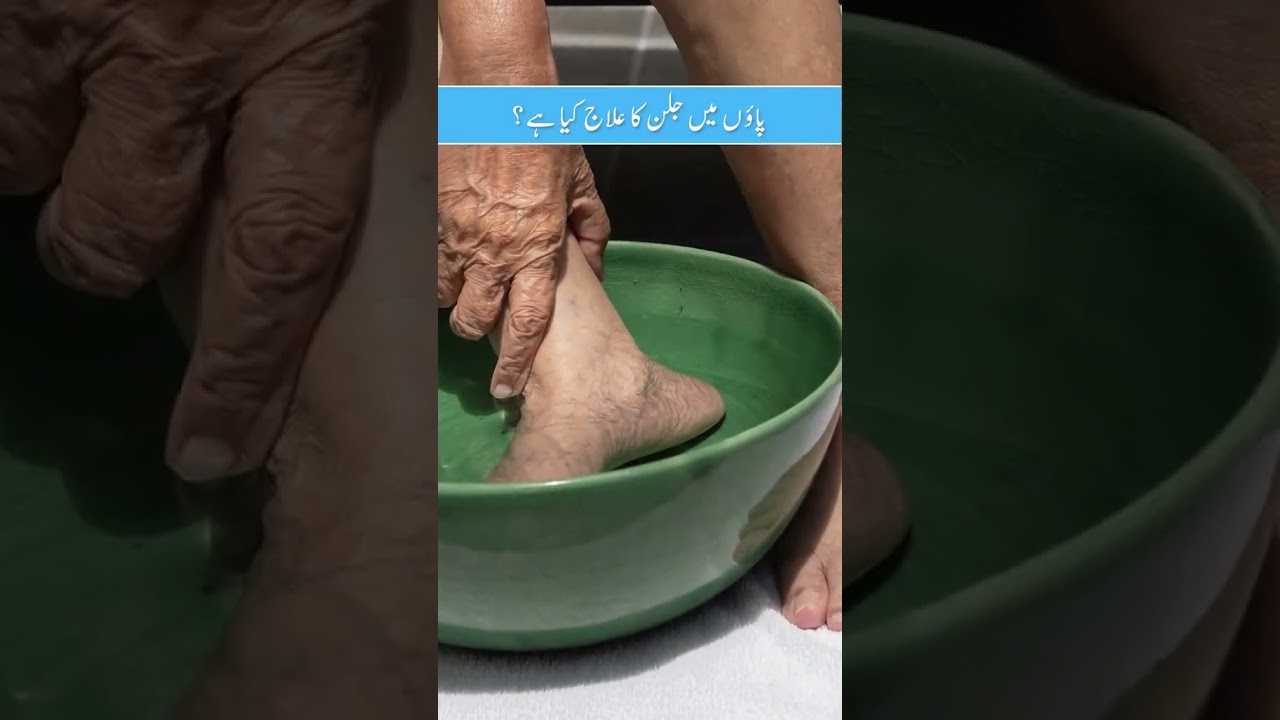 What is the treatment for burning feet? - Paon Me Jalan Ka Kya Ilaj Hai? #burningfeet #burningfeet
