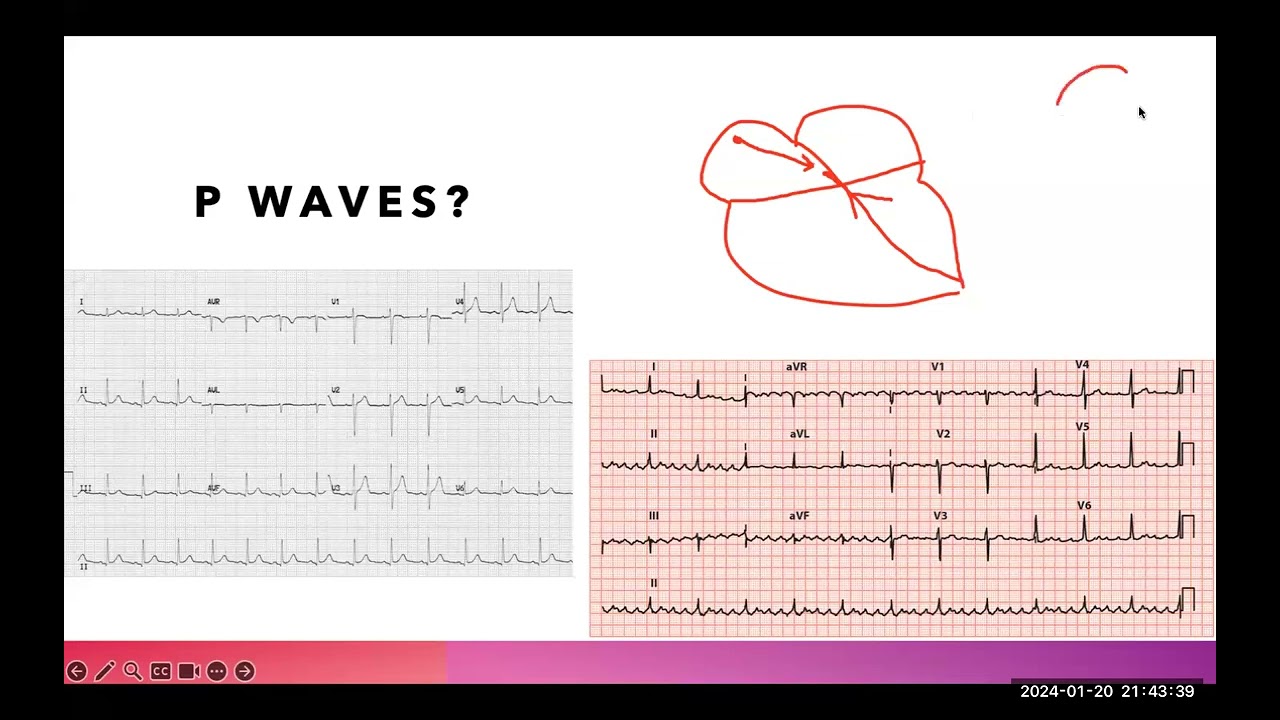 Introduction of ECG and Arrhythmia  part 2By Dr Mohmaed ElMaghawry