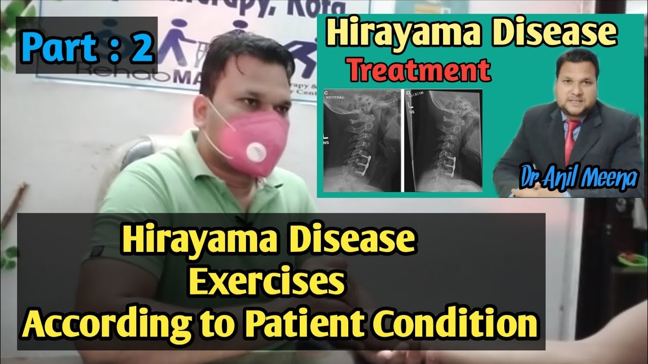 Hirayama disease Treatment and Exercise  | Hirayama Disease Exercises | hirayama disease | In Hindi