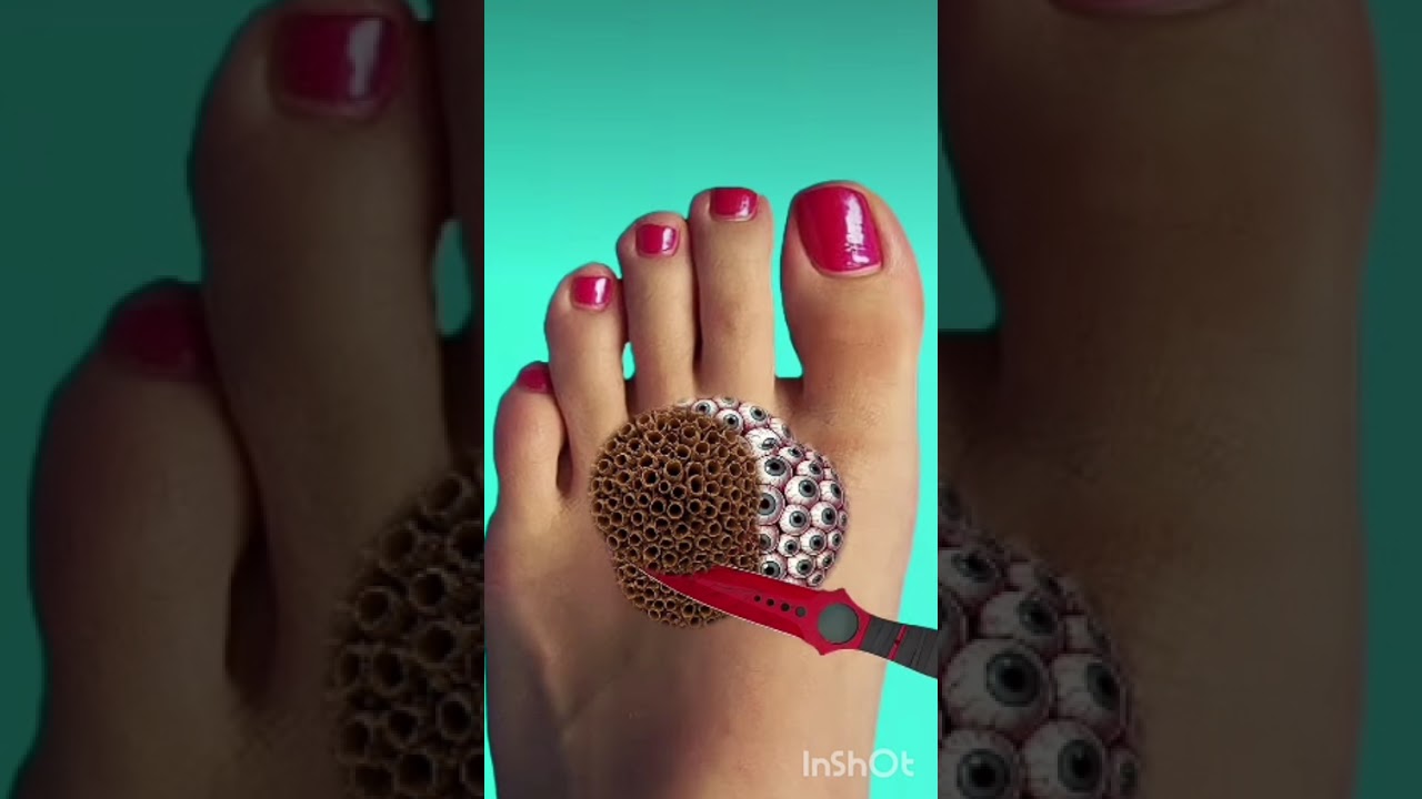 ASMR 2d relaxing sound 🤯🤯 animation treatment for legs #animation #samr