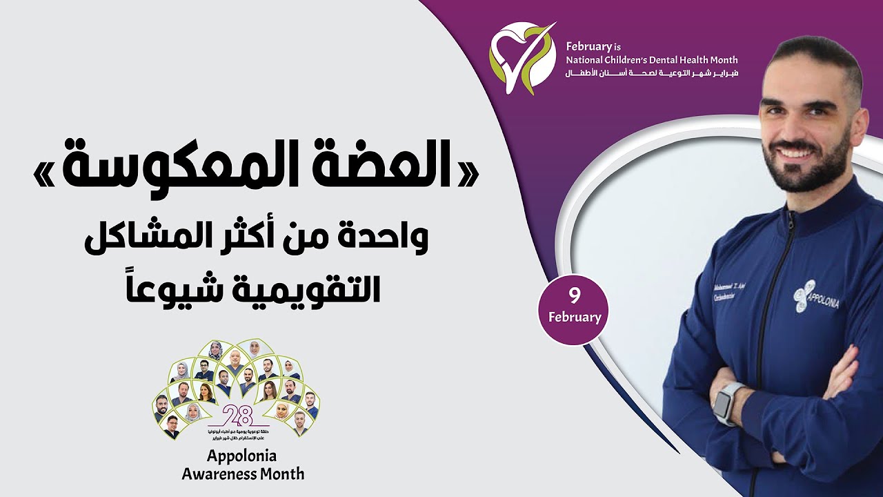 العضة المعكوسةواحدة من أكثر المشاكل التقويمية شيوعاً