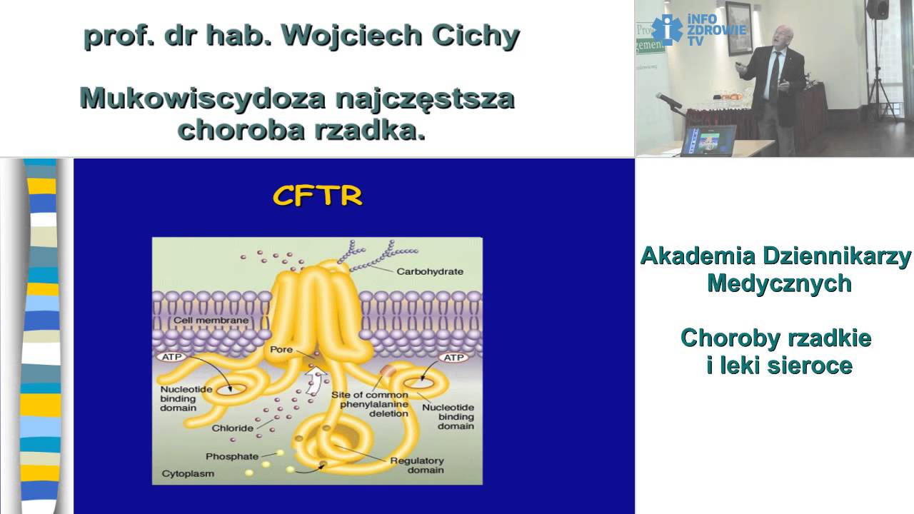 Mukowiscydoza najczęstsza choroba rzadka