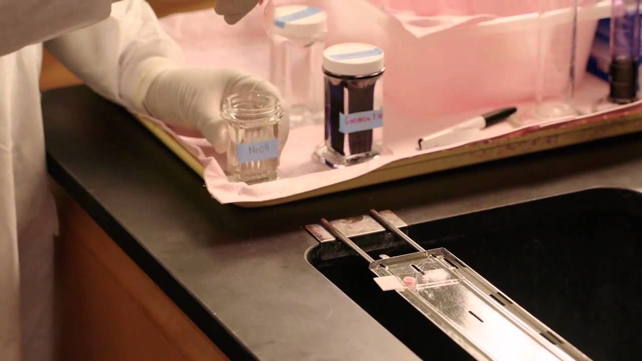 Microscopía del Paludismo - Una Guía paso a paso