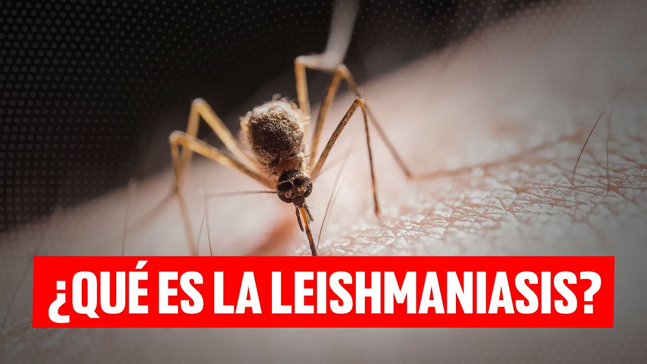 Leishmaniasis: la úlcera del chichero, una enfermedad en Yucatán