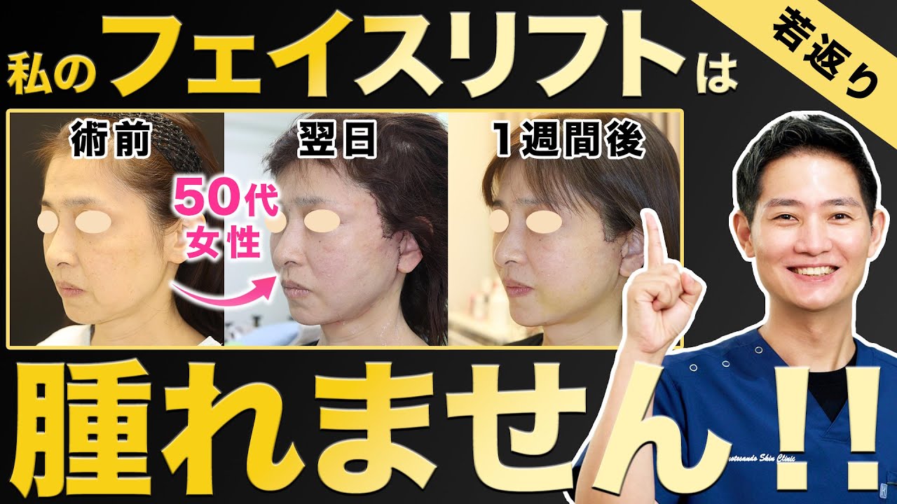 【たるみ解消】切開フェイスリフトは術後に病むの？気になるダウンタイムを大公開！