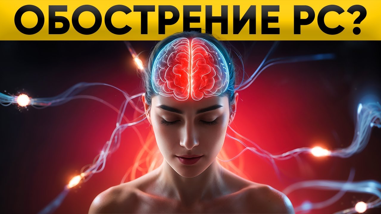 Как лечить ОБОСТРЕНИЕ при Рассеянном Склерозе