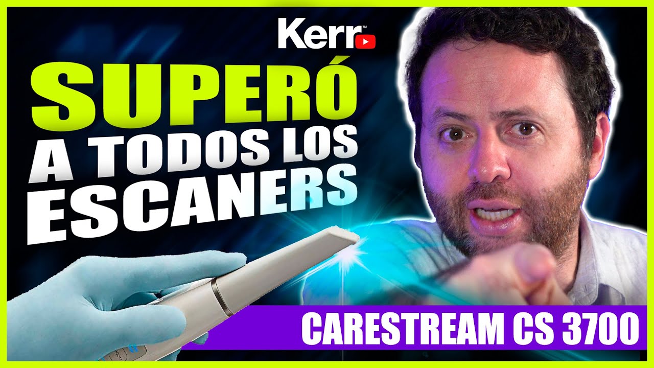 🔥Carestream CS 3700🔥 el escáner que SUPERÓ a la competencia 👌