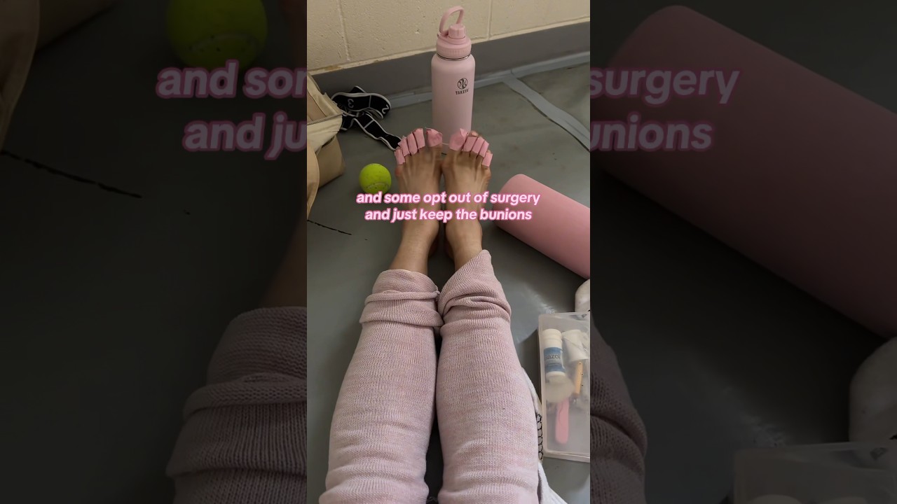 BUNIONS IN BALLET #bunion#ballerina#ballet#surgery#dancer#didyouknow#funfact#explained