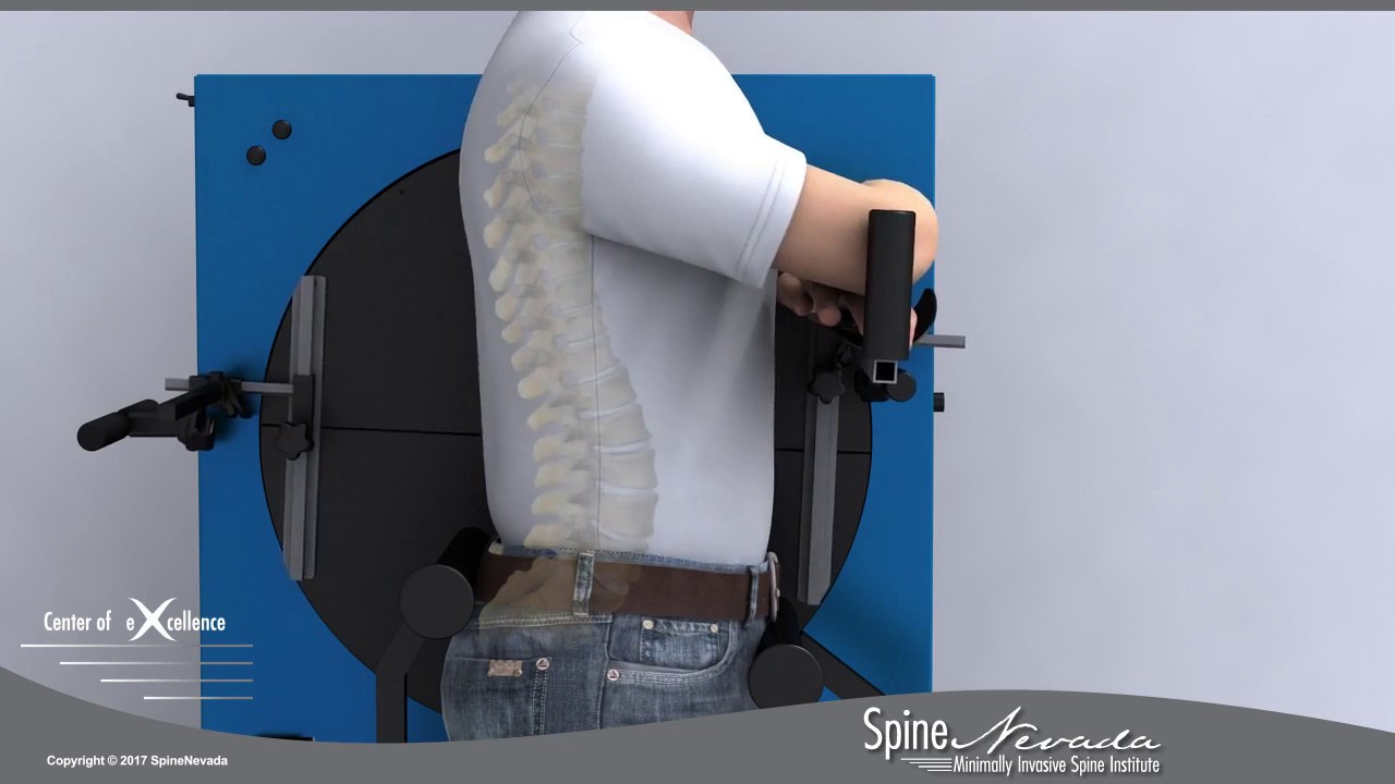 View spinal motion like a movie &mdash; Vertebral Motion Analysis (VMA) for Lumbar spine