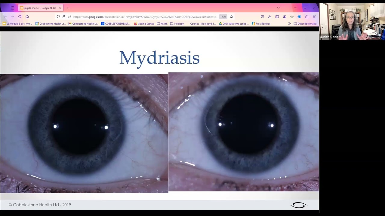 What important info do the pupils add to an iris assessment?