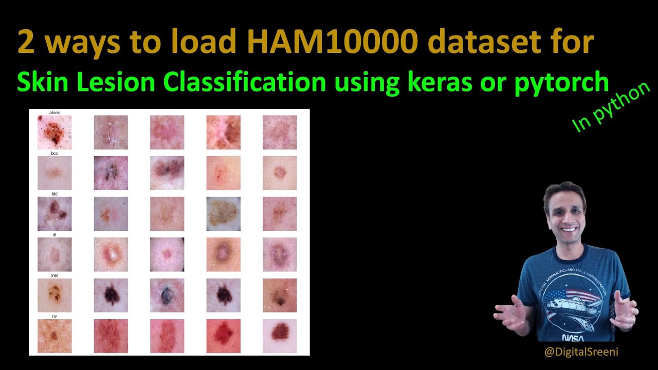 202 - Two ways to read HAM10000 dataset into python for skin cancer lesion classification