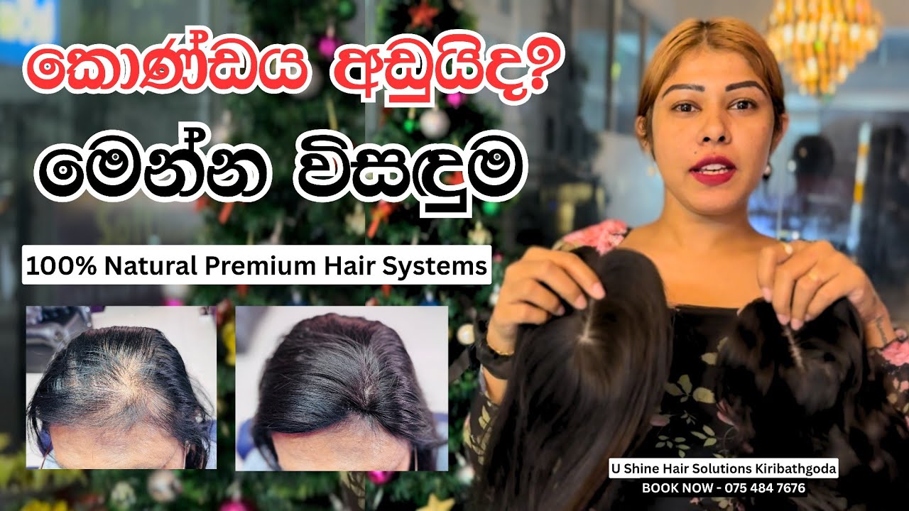 කොණ්ඩය අඩුද? මෙන්න විසඳුම! | Natural Hair Replacement @ U Shine Kiribathgoda