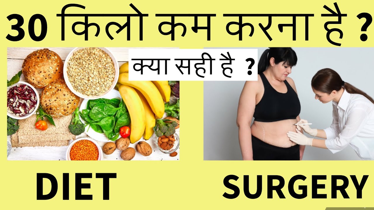 DIET vs SURGERY ? 30 KG WEIGHT LOSS ke liye kon sa option hai ? WHY I am NOT ABLE TO LOSE WEIGHT ?