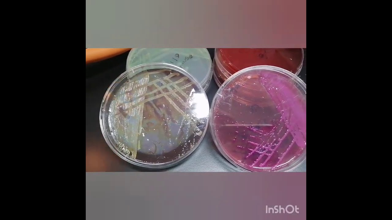 كيفية عزل البكتيريا streaking of bacteria plate methods