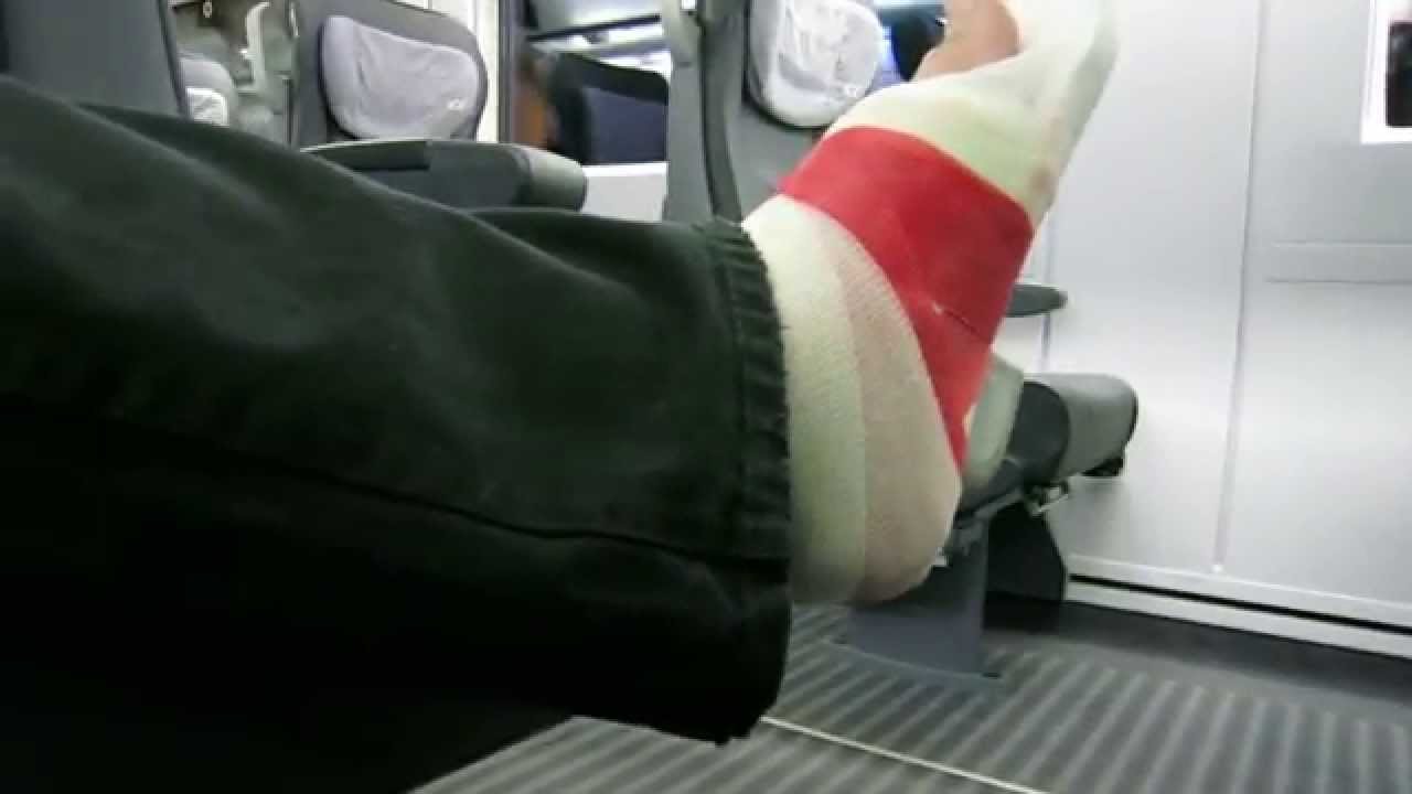 Mit rot-wei&szlig;em Gipsbein nach Berlin (Teil 1: im ICE)