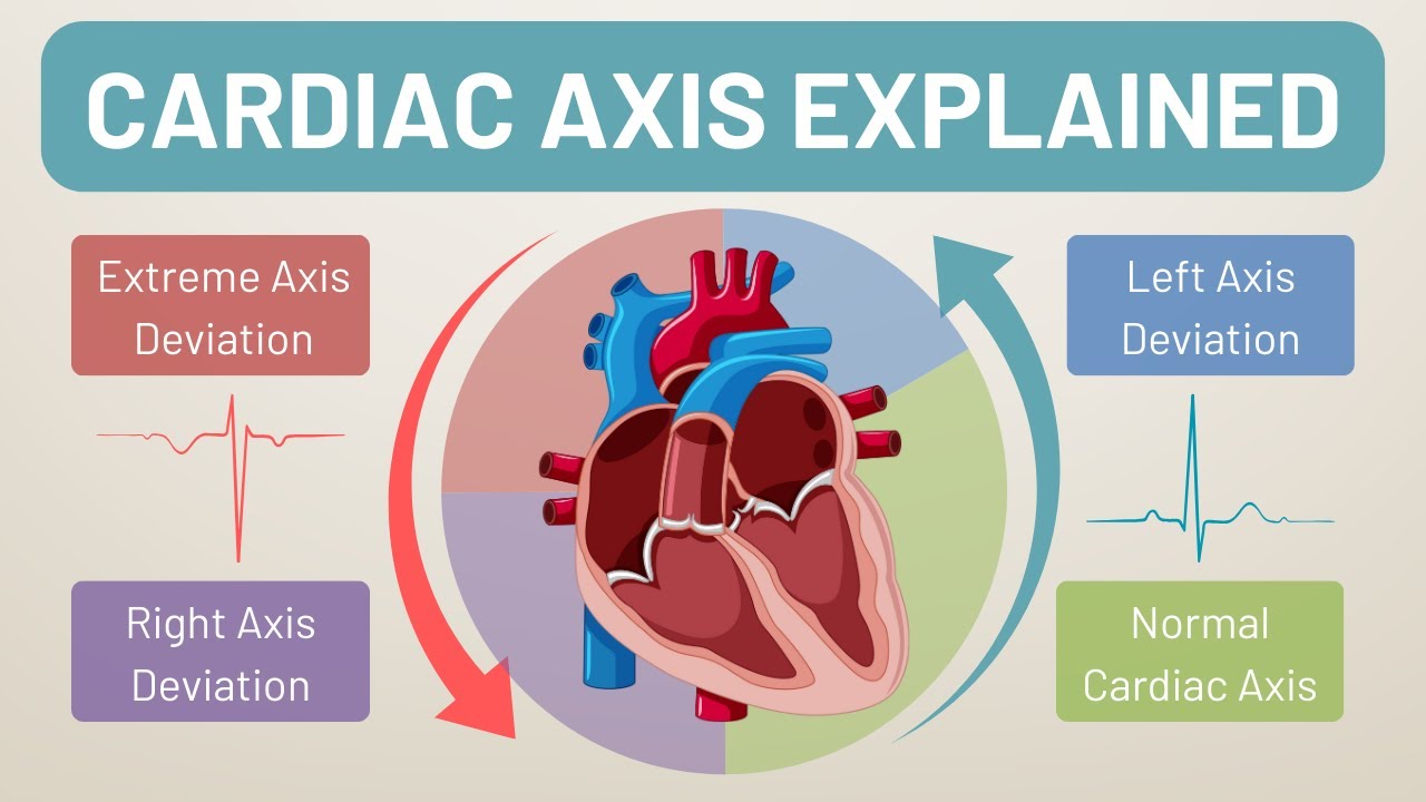 How to Calculate Cardiac Axis | ECG Interpretation