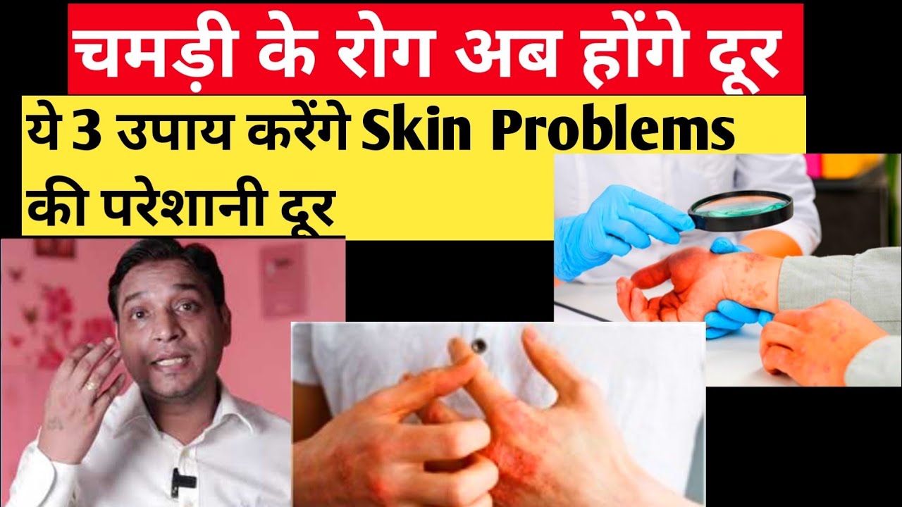 चमड़ी के रोग के कारण और उपाय | Factors Behind Skin Problems With Effective #remedies #lalkitab