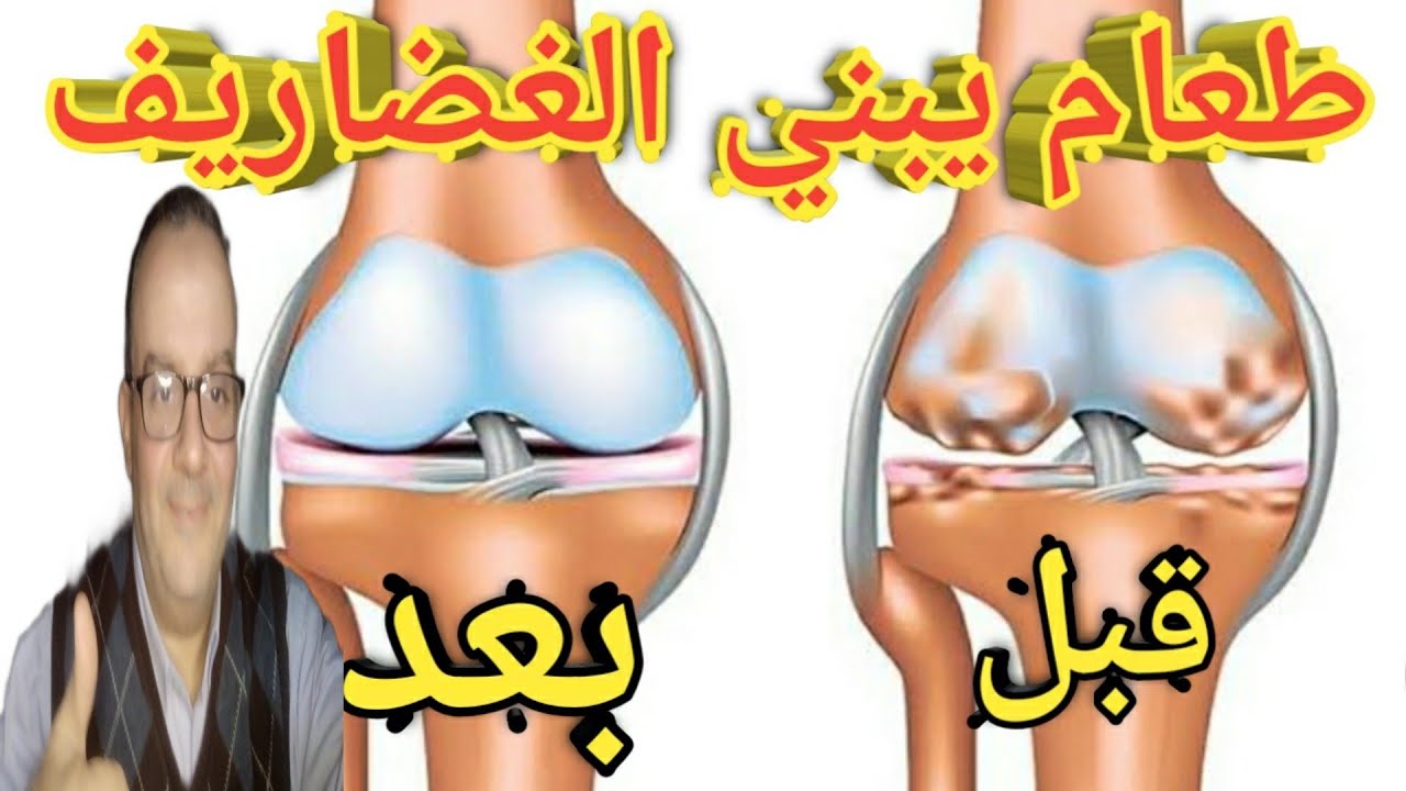 افضل وجبة للمفاصل لبناء الغضاريف/اطعمه ترمم طبقات الغضاريف+ مشروب يبني الغضاريف/وداعا خشونة المفاصل