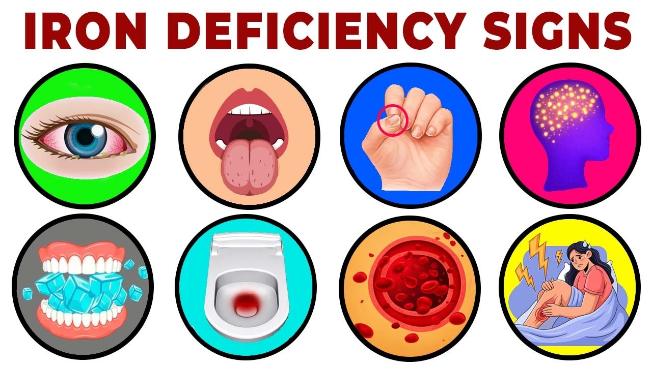 11 Signs of Iron Deficiency You Can See | Health Explained