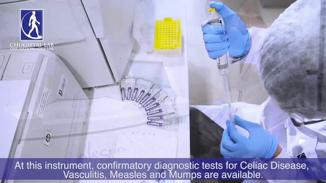 Chemical Pathology Department l Chughtai Lab