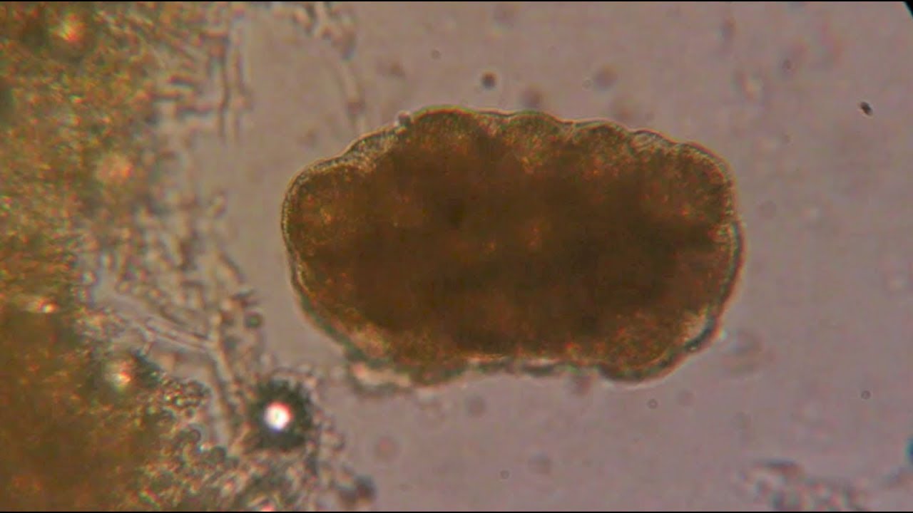 Dypilidium caninum. CIAB www.ciab.es.