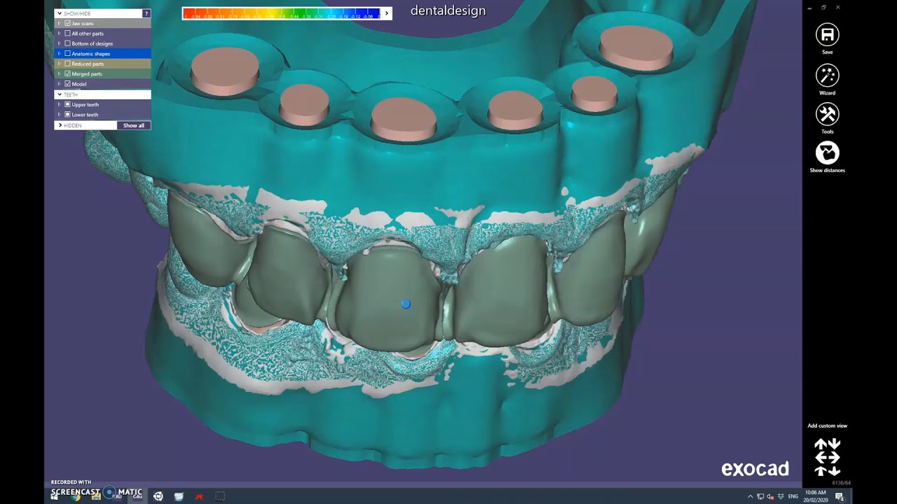 12 units: Constructing 3D models with Exocad Model Creator