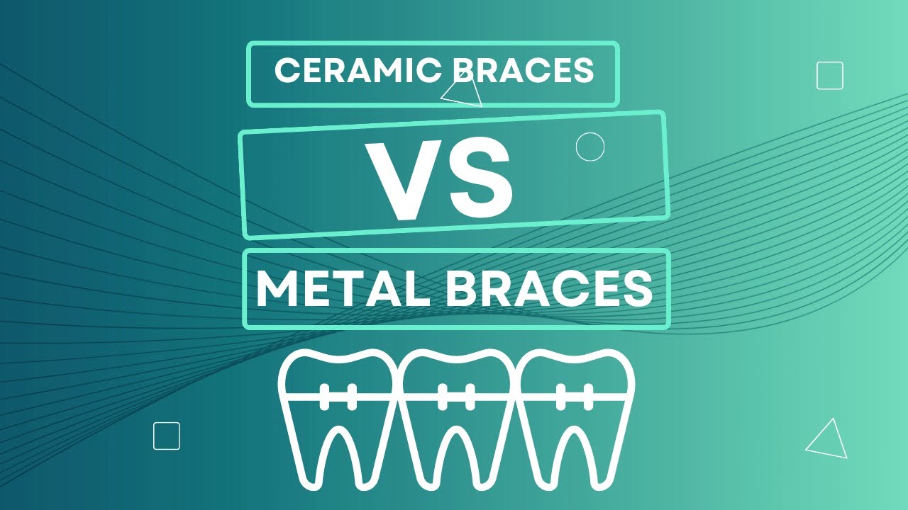Ceramic vs Metal Braces: What are their differences?