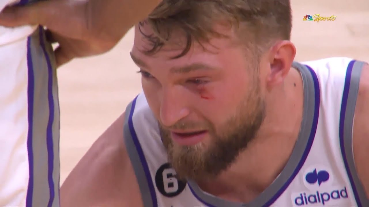 Domantas Sabonis eye bleeding after he gets elbowed by Kevon Looney 😬
