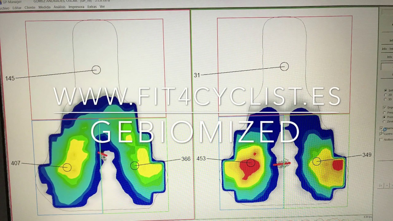 GebioMized: pressure mapping analysis.  Comparison of different saddle types.
