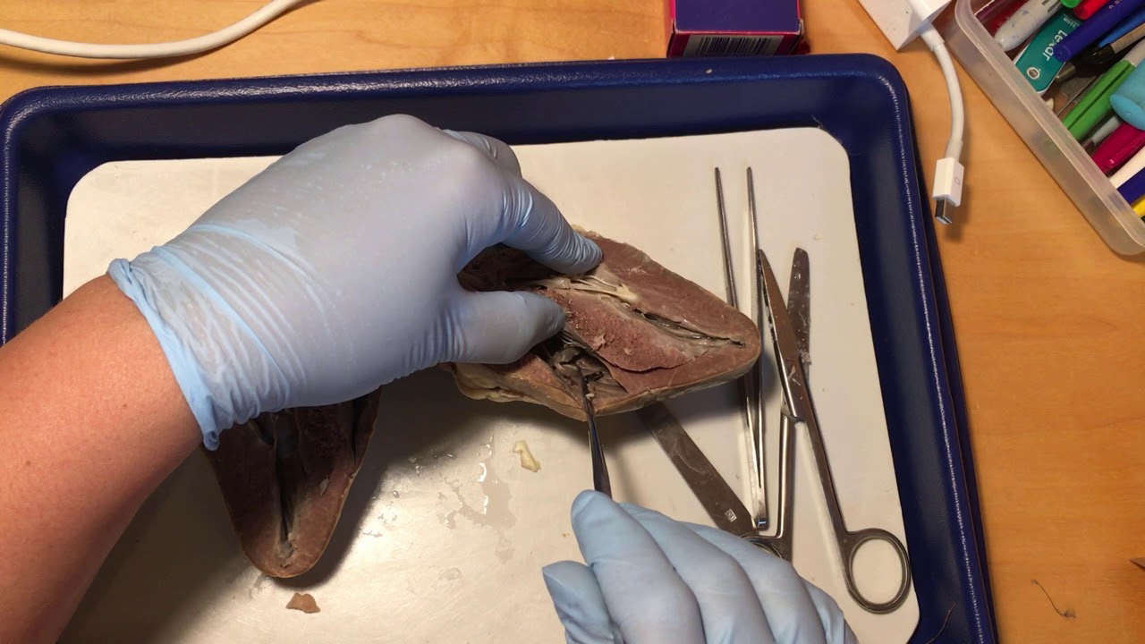 Heart Dissection