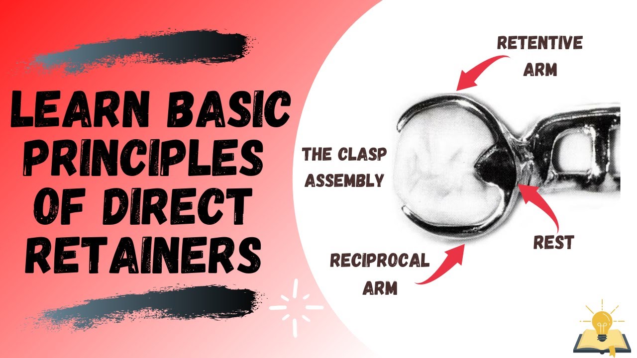 Direct retainers | The Basic Principles | Removable Partial Denture (RPD)