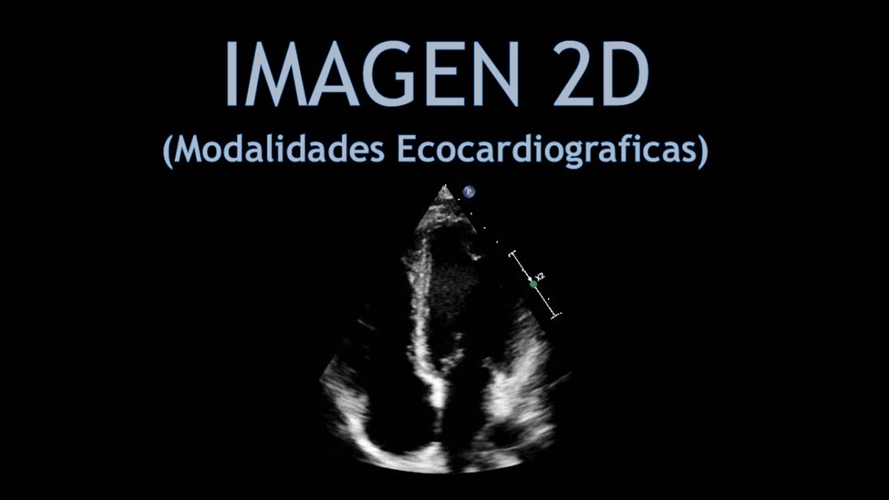 2D ECO + Optimizacion de las imagenes! (Ecocardiografia)