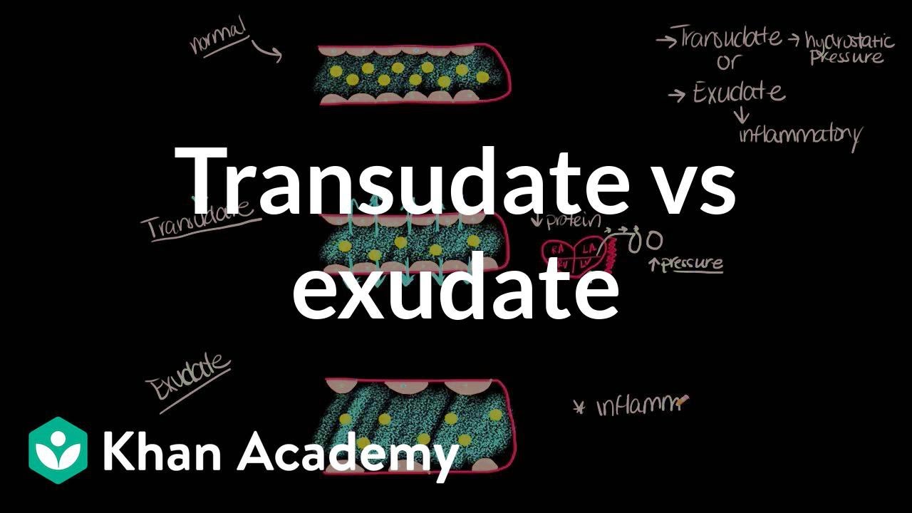 Transudate vs exudate | Respiratory system diseases | NCLEX-RN | Khan Academy