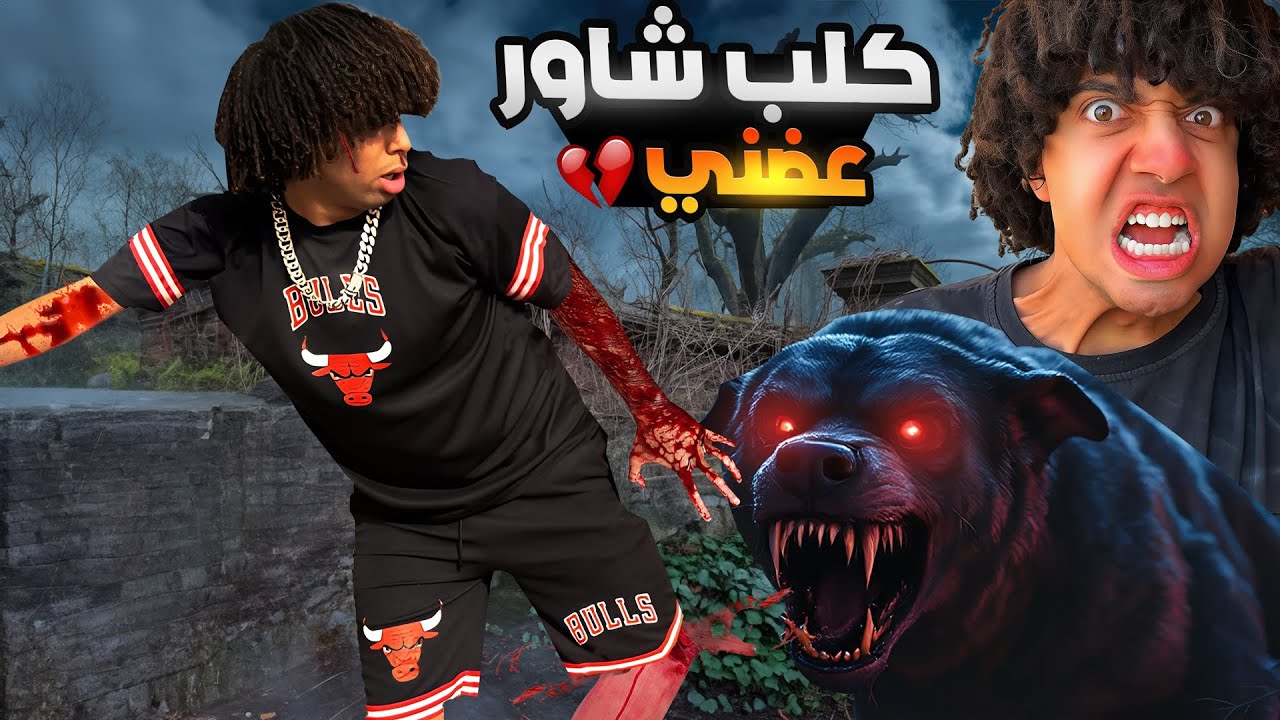 الكلب المسعور بتاع شاور هجم عليا وعضني شاور السبب😱😭!!