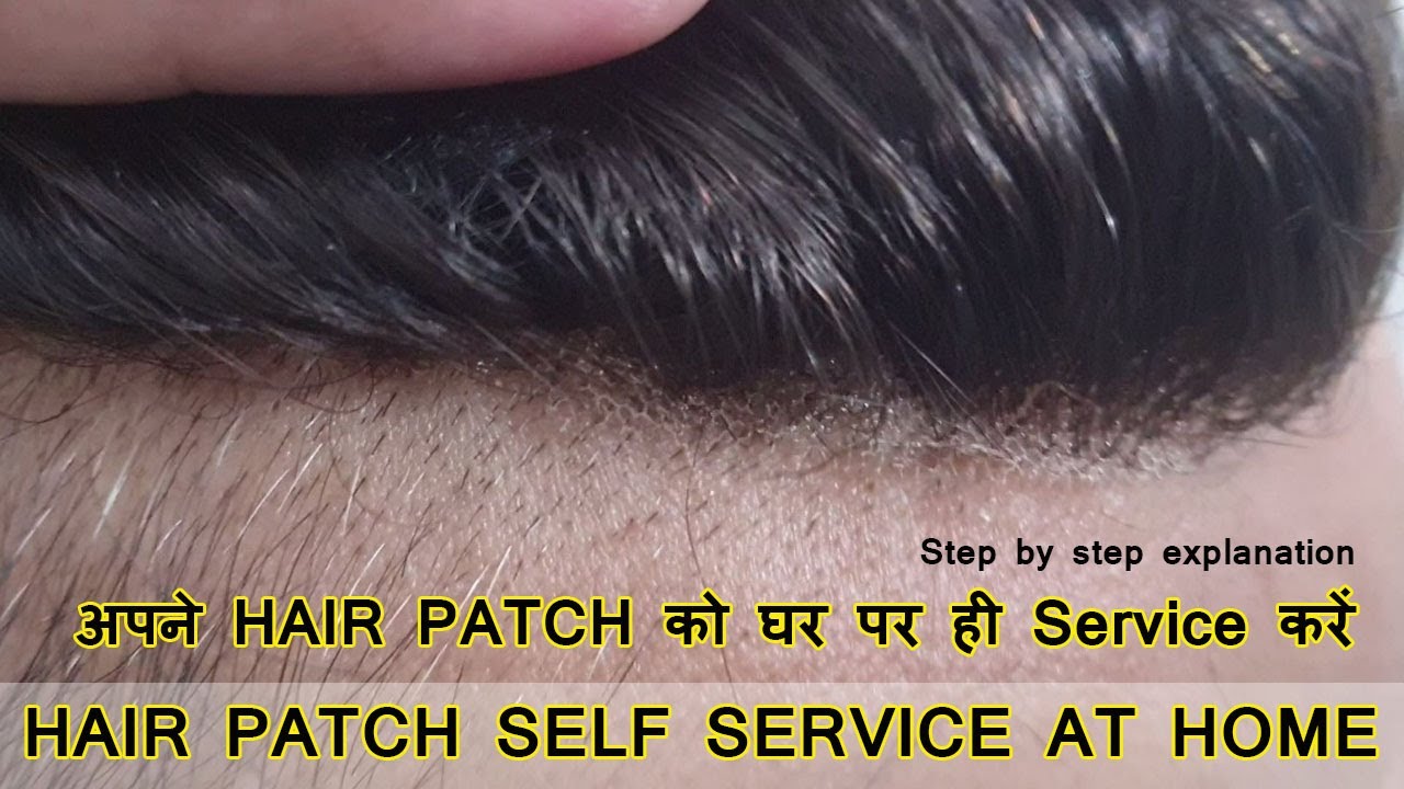 How to do Hair Patch Self Service at Home | Step by Step Explanation | Planet of Hair Cloning